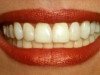 Eksperte: zobu saslimšana var izraisīt arī citas organisma problēmas